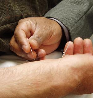 Specialist inserting a small acupuncture needle into a man's forearm