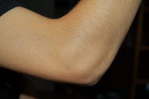 Photo of elbow