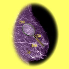 Image from Breast Cancer Detective X-Ray of Breast with Magnifying Glass