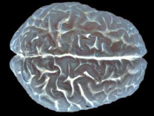 image scan of brain