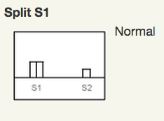 Split S1 versus Normal Graph